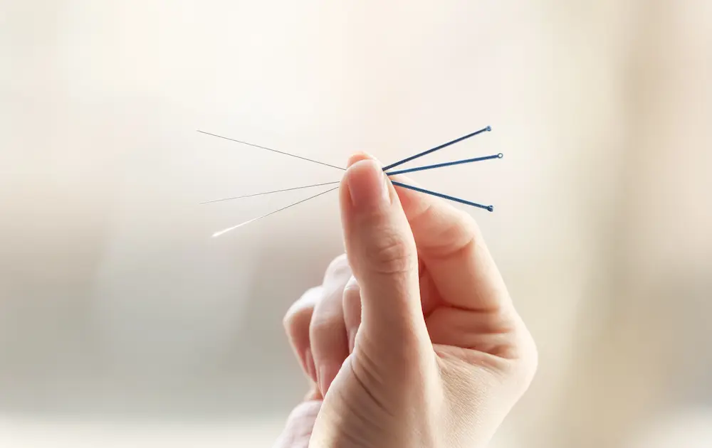 Female hand with needles for acupuncture on blurred background